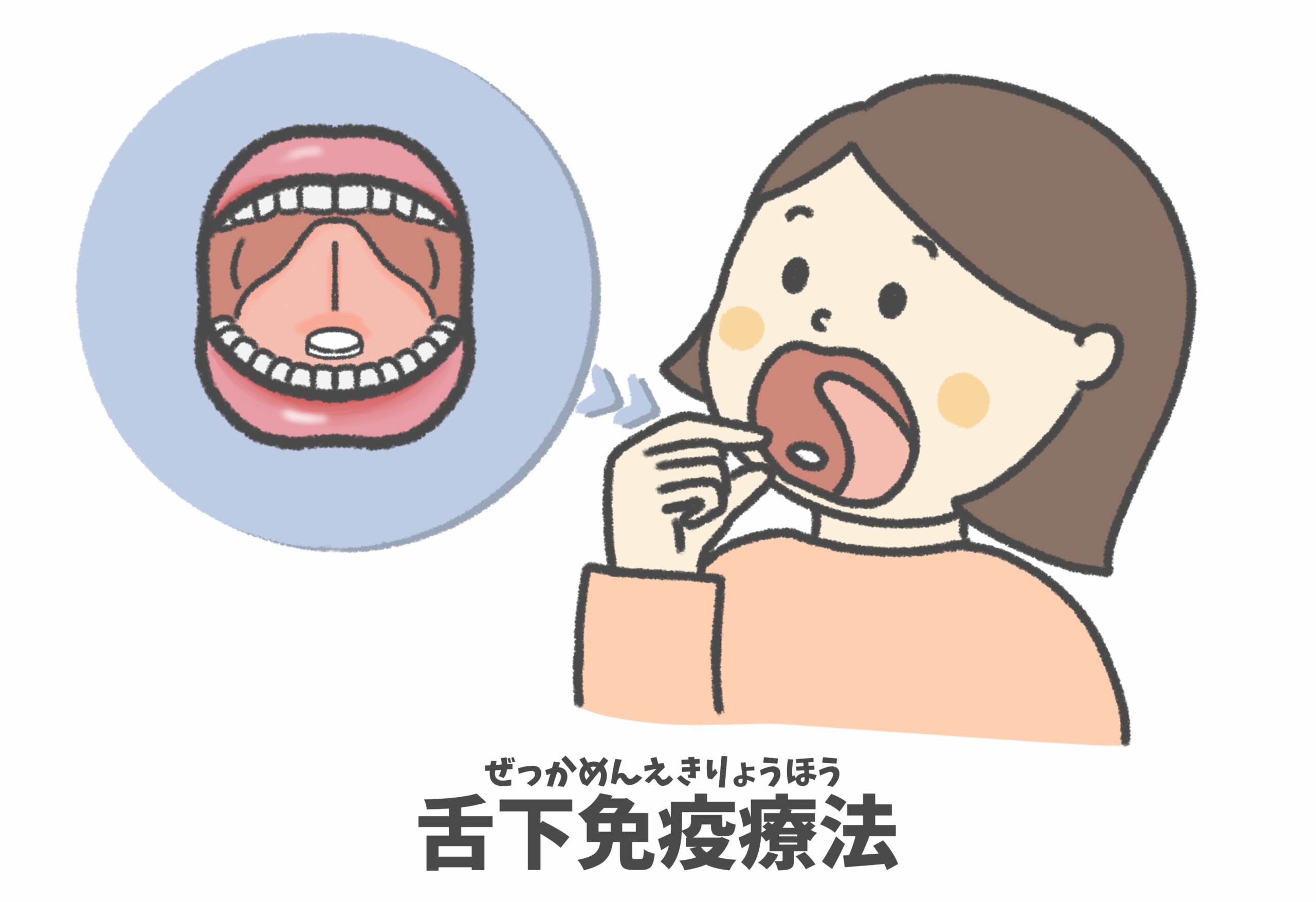 舌 下 免疫 療法
